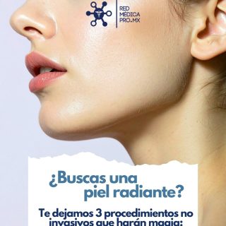 💆🏻✨

#RedMédicaPro #SaludYEstética #radiesse #HIFU #pdrndesalmón #cirujanoscdmx