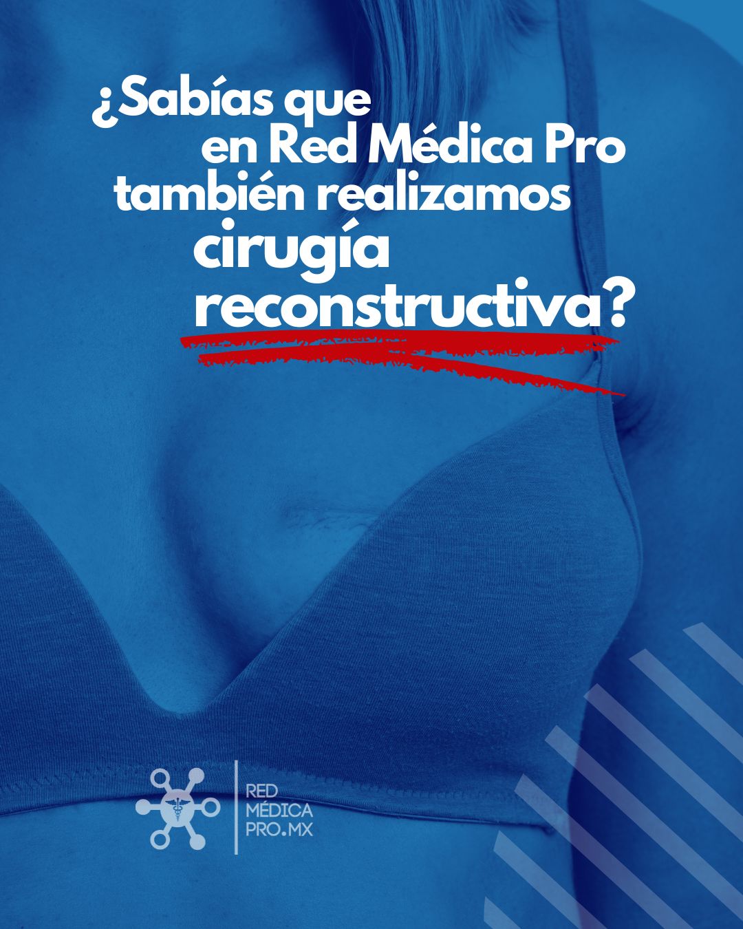 Más allá de la estética: restauramos tu esencia🌸

🔵Estamos especializados en Cirugía Reconstructiva, un área de la medicina que devuelve la funcionalidad y la armonía a tu cuerpo tras enfermedades, accidentes o procesos congénitos 🩺✨

👉🏼Para muchas mujeres, este procedimiento representa el cierre de un capítulo difícil y el inicio de una nueva etapa llena de confianza🫂🫰

Si tienes dudas sobre los alcances de la cirugía reconstructiva, envíanos un mensaje directo 📩

#RedMédicaPro #CirugíaReconstructiva #SaludIntegral #CirujanosCertificados #ReconstrucciónMamaria #MedicinaConPropósito