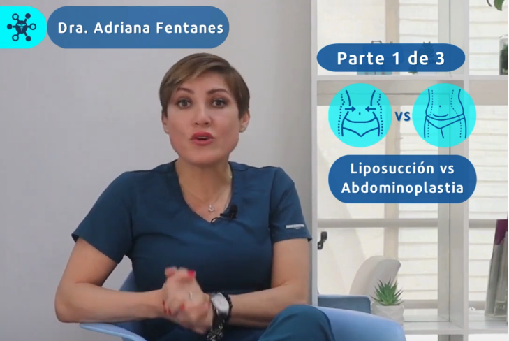 Liposucción vs Abdominoplastía